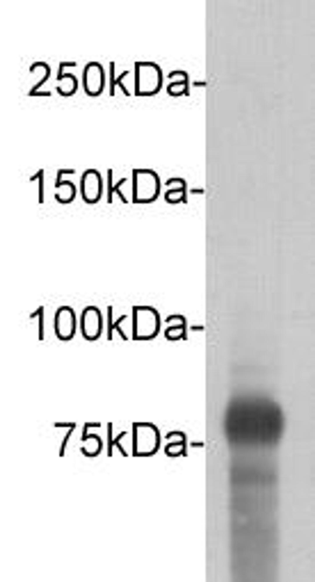 Western Blot analysis of DYKDDDDK tag recombinant protein (80kDa) using DYKDDDDK-tag antibody