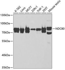 Western blot - NDC80 antibody (A5411)