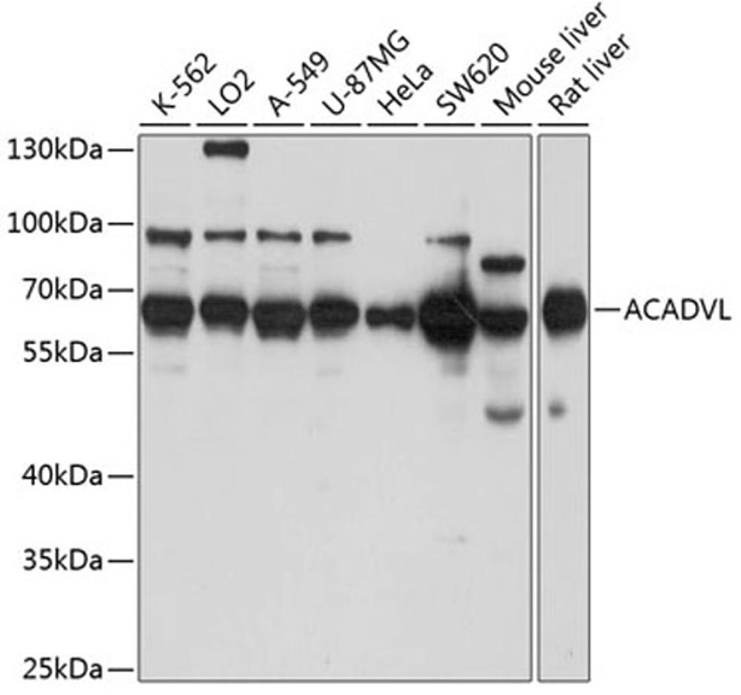 Western blot - ACADVL antibody (A7865)