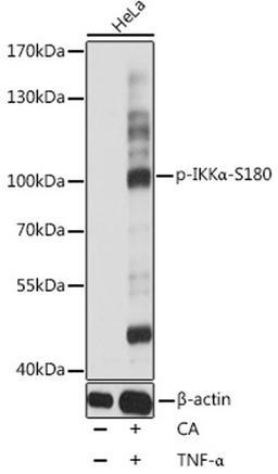 Western blot - Phospho-IKKa-S180 antibody (AP0506)