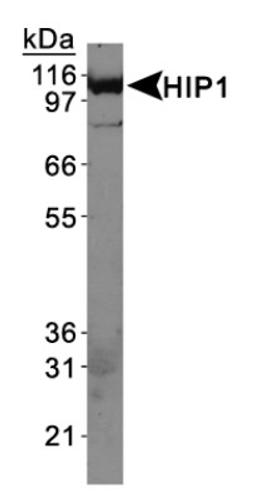 Western Blot: HIP1 Antibody (4B10) [NB300-203] - Western Blot on HeLa whole cell extracts.