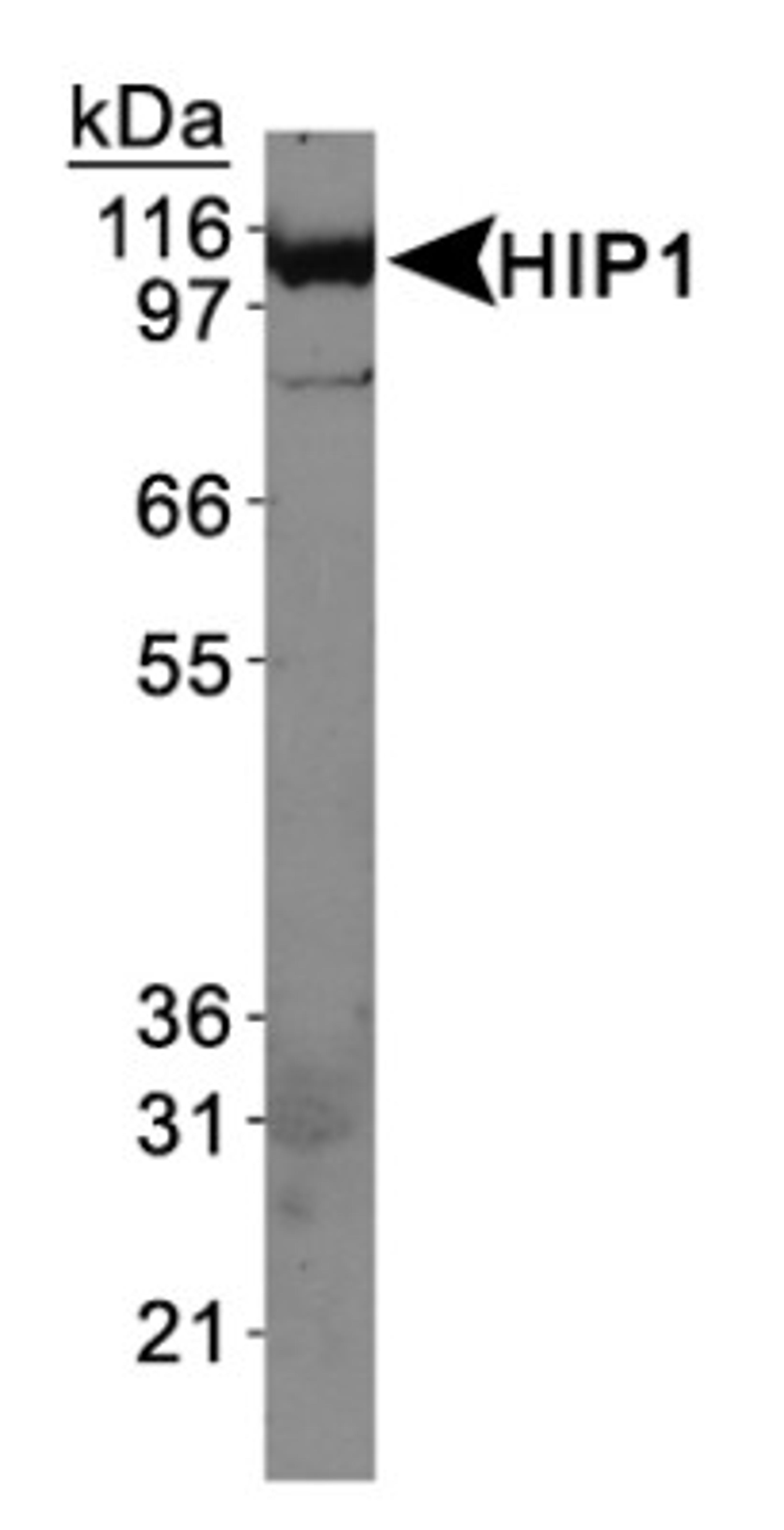 Western Blot: HIP1 Antibody (4B10) [NB300-203] - Western Blot on HeLa whole cell extracts.