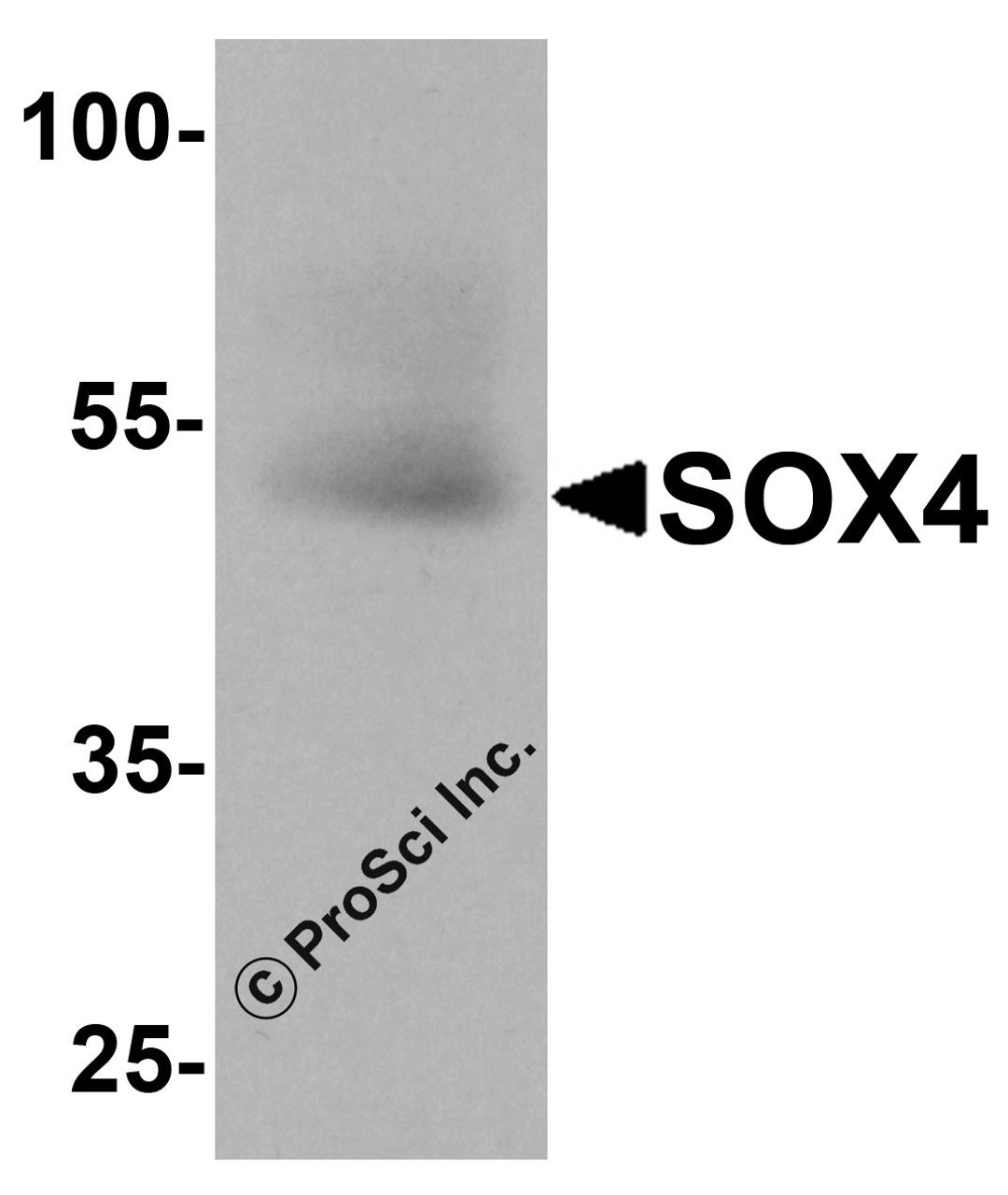 Western blot analysis of SOX4 in human testis tissue lysate with SOX4 antibody at 1 μg/ml.