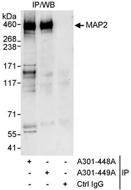 Detection of human MAP2 by WB of IP.