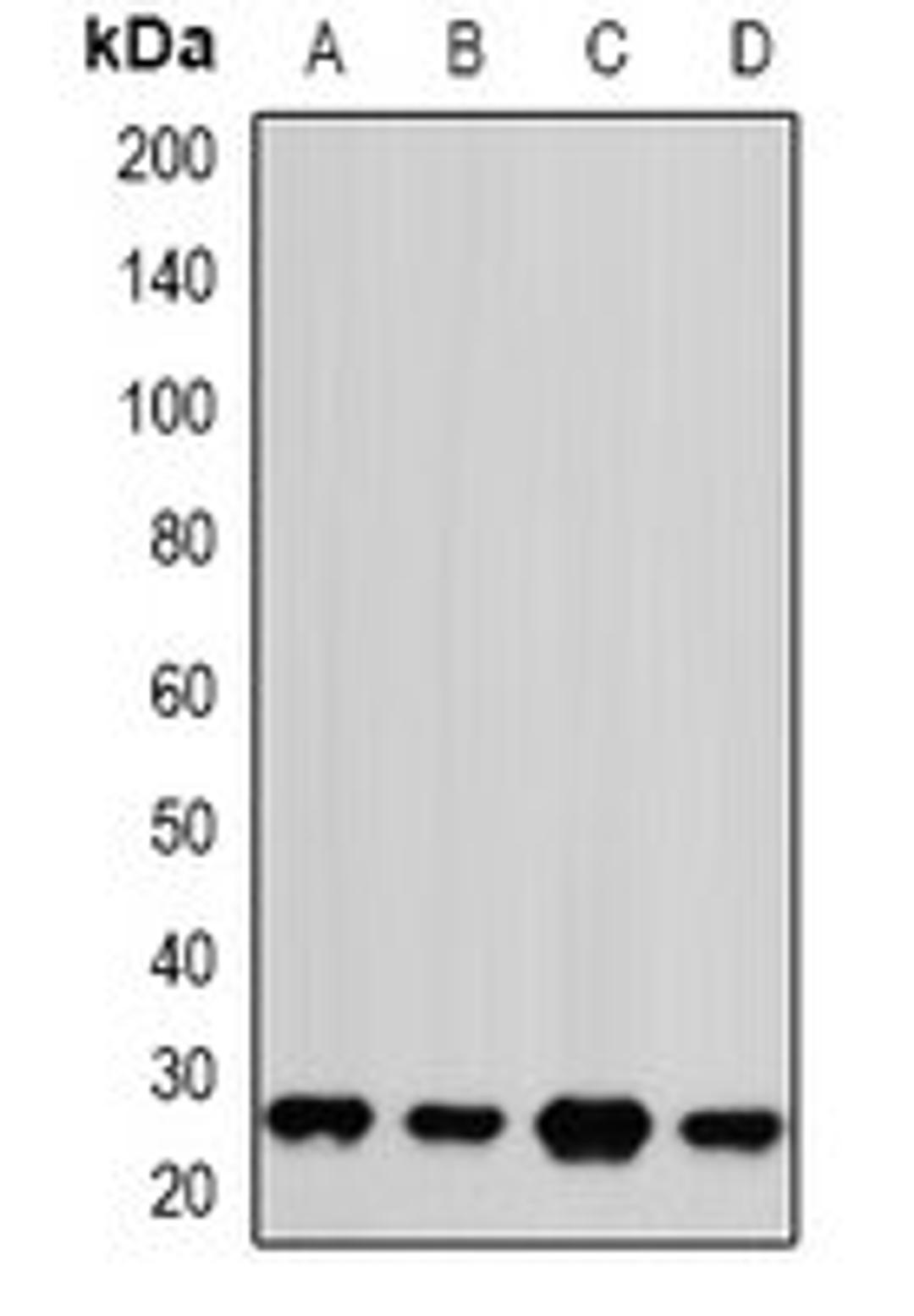 Western blot analysis of Jurkat (Lane1), Hela (Lane2), NIH3T3 (Lane3), mouse brain (Lane4) whole cell lysates using PSMA2 antibody