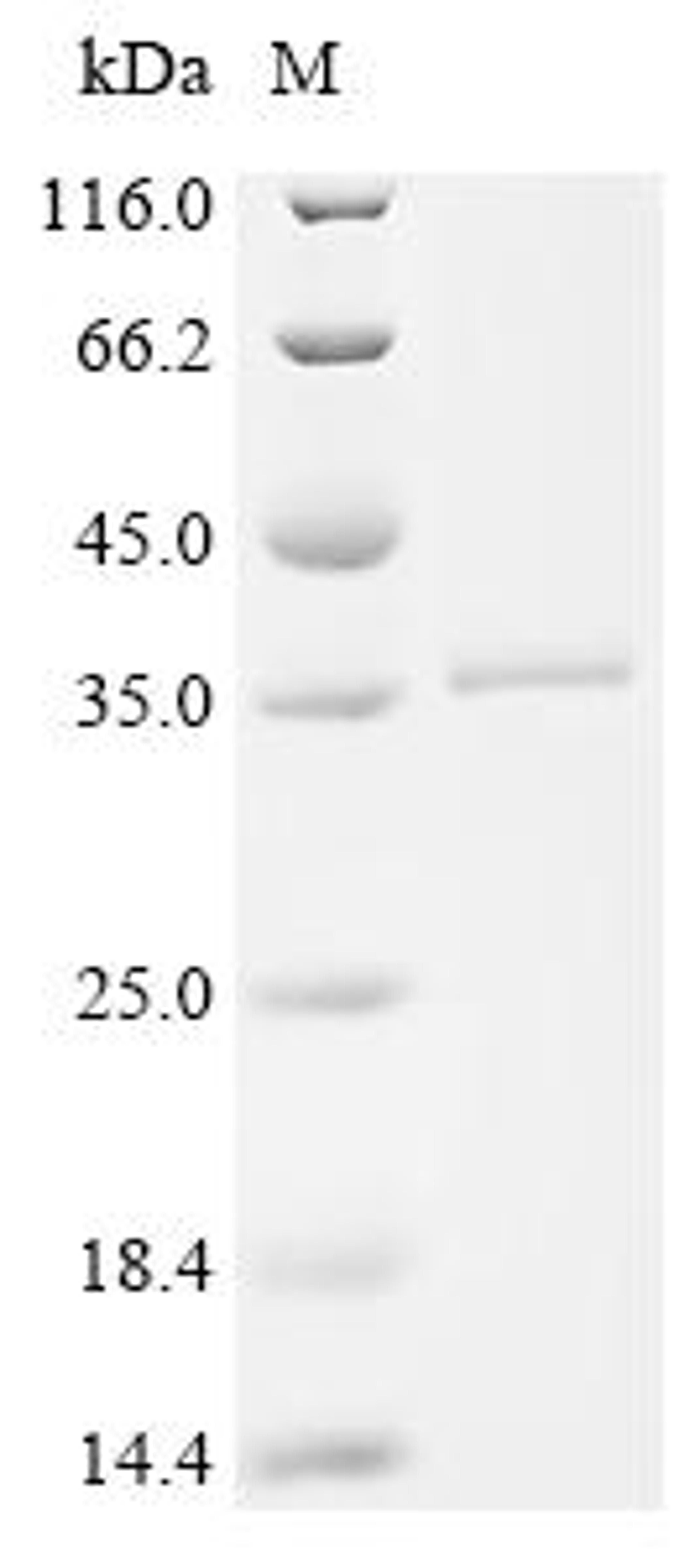 (Tris-Glycine gel) Discontinuous SDS-PAGE (reduced) with 5% enrichment gel and 15% separation gel.