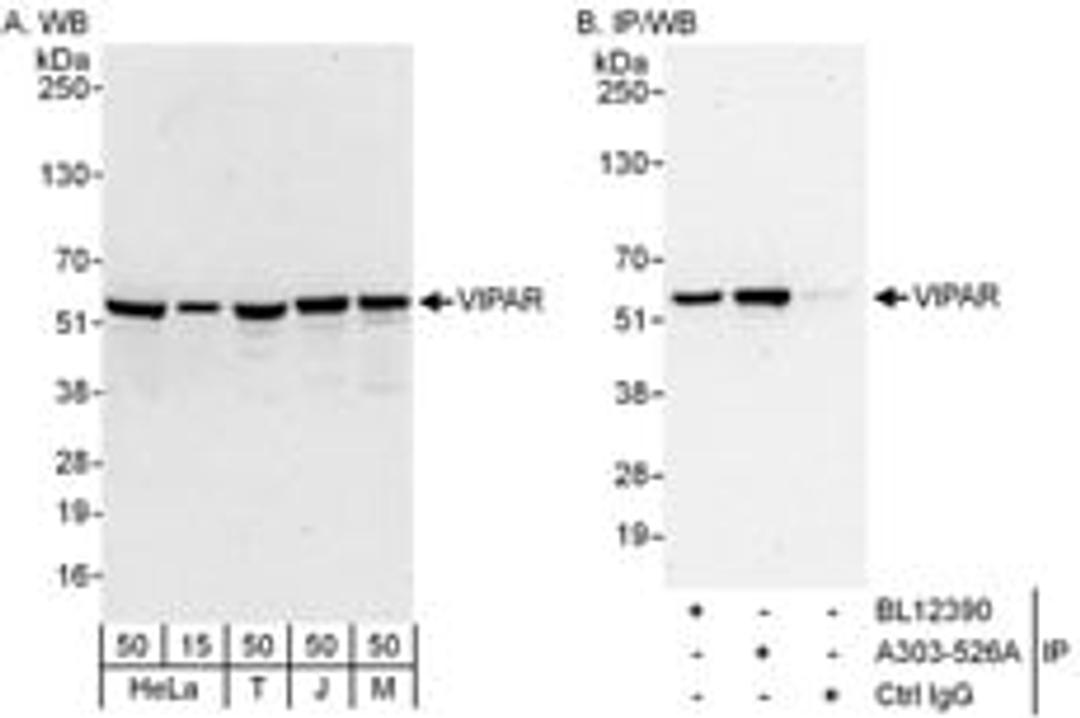 Detection of human and mouse VIPAR by western blot (h and m) and immunoprecipitation (h).