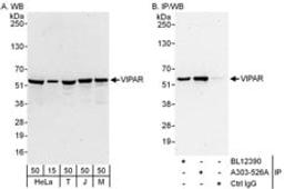 Detection of human and mouse VIPAR by western blot (h and m) and immunoprecipitation (h).