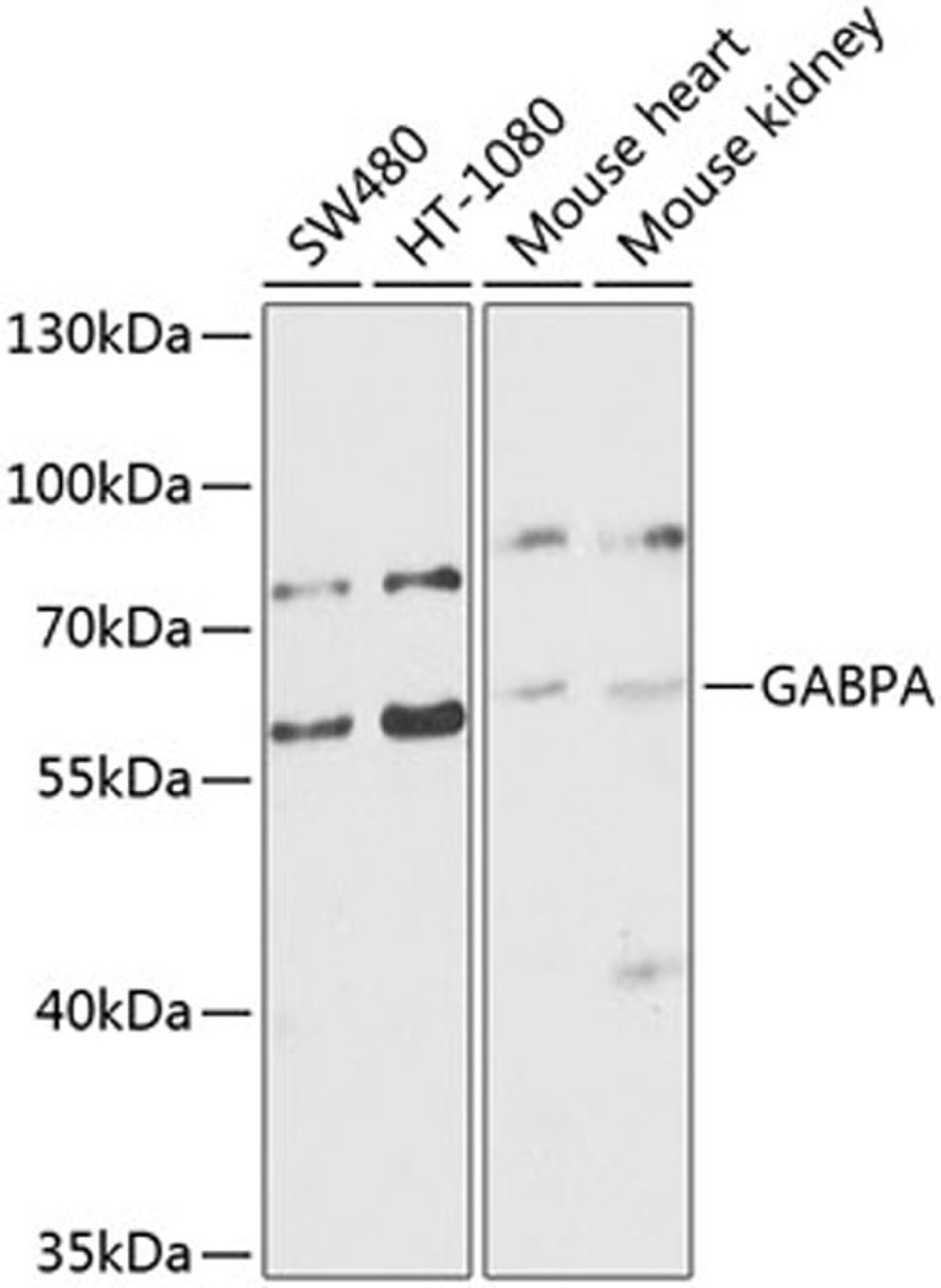 Western blot - GABPA antibody (A8419)