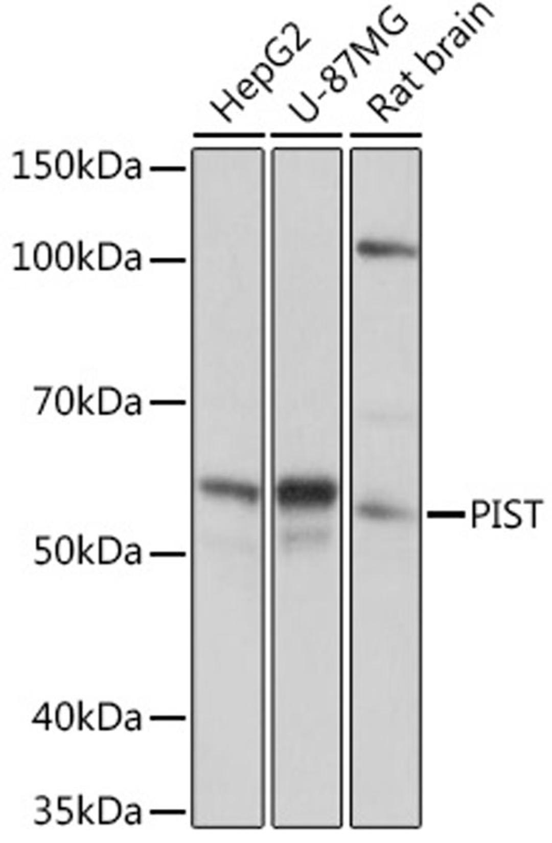 Western blot - PIST Rabbit mAb (A0582)