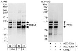 Detection of human RBEL1 by western blot and immunoprecipitation.