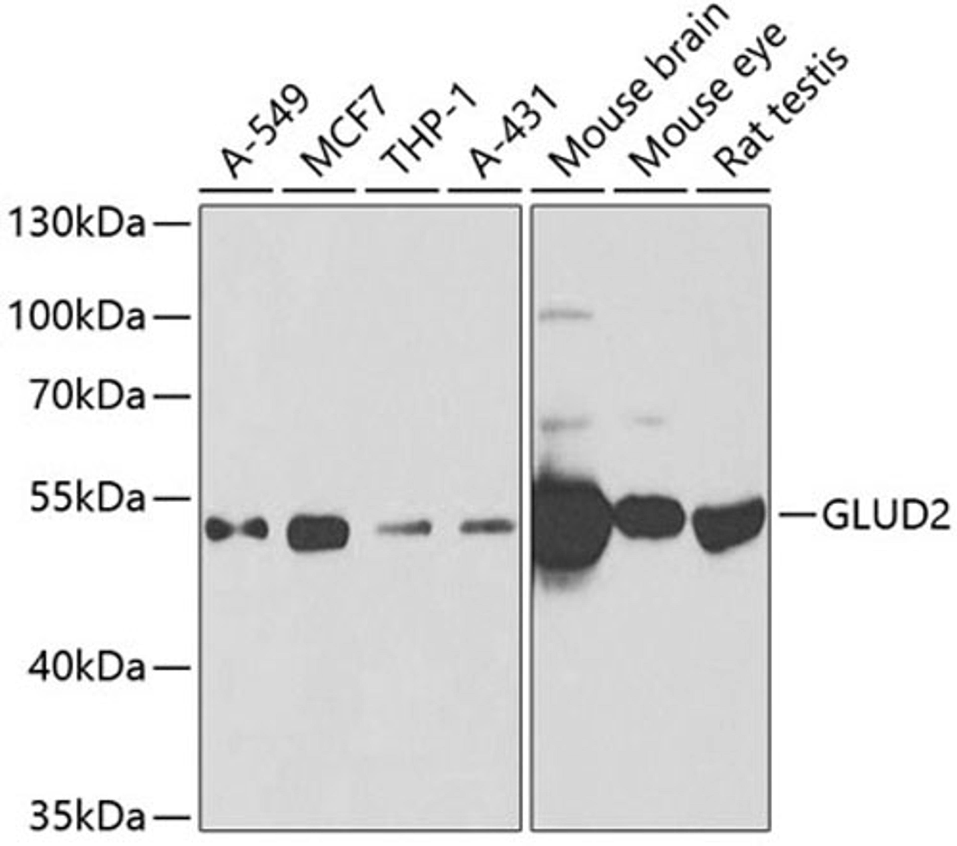 Western blot - GLUD2 antibody (A6604)