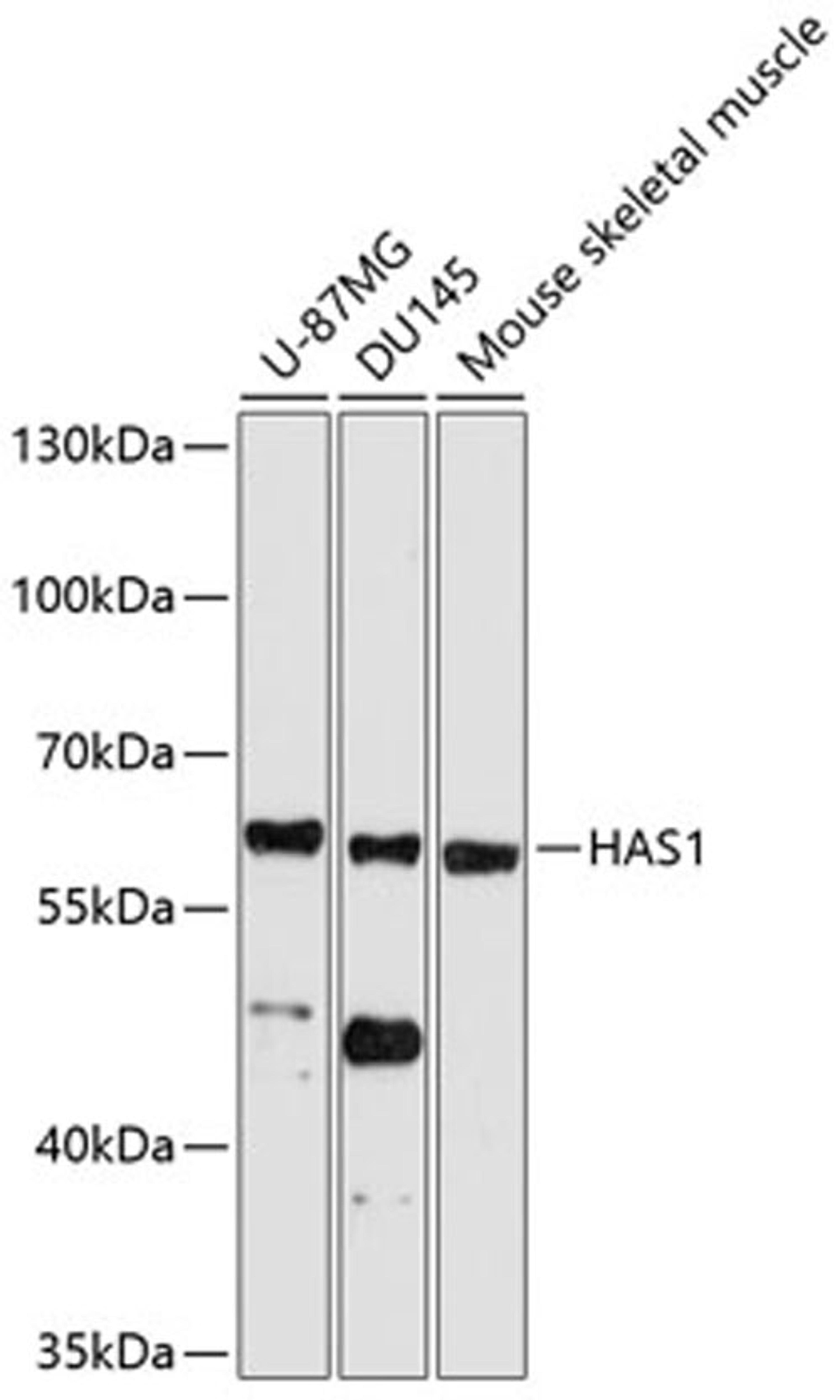 Western blot - HAS1 antibody (A10453)