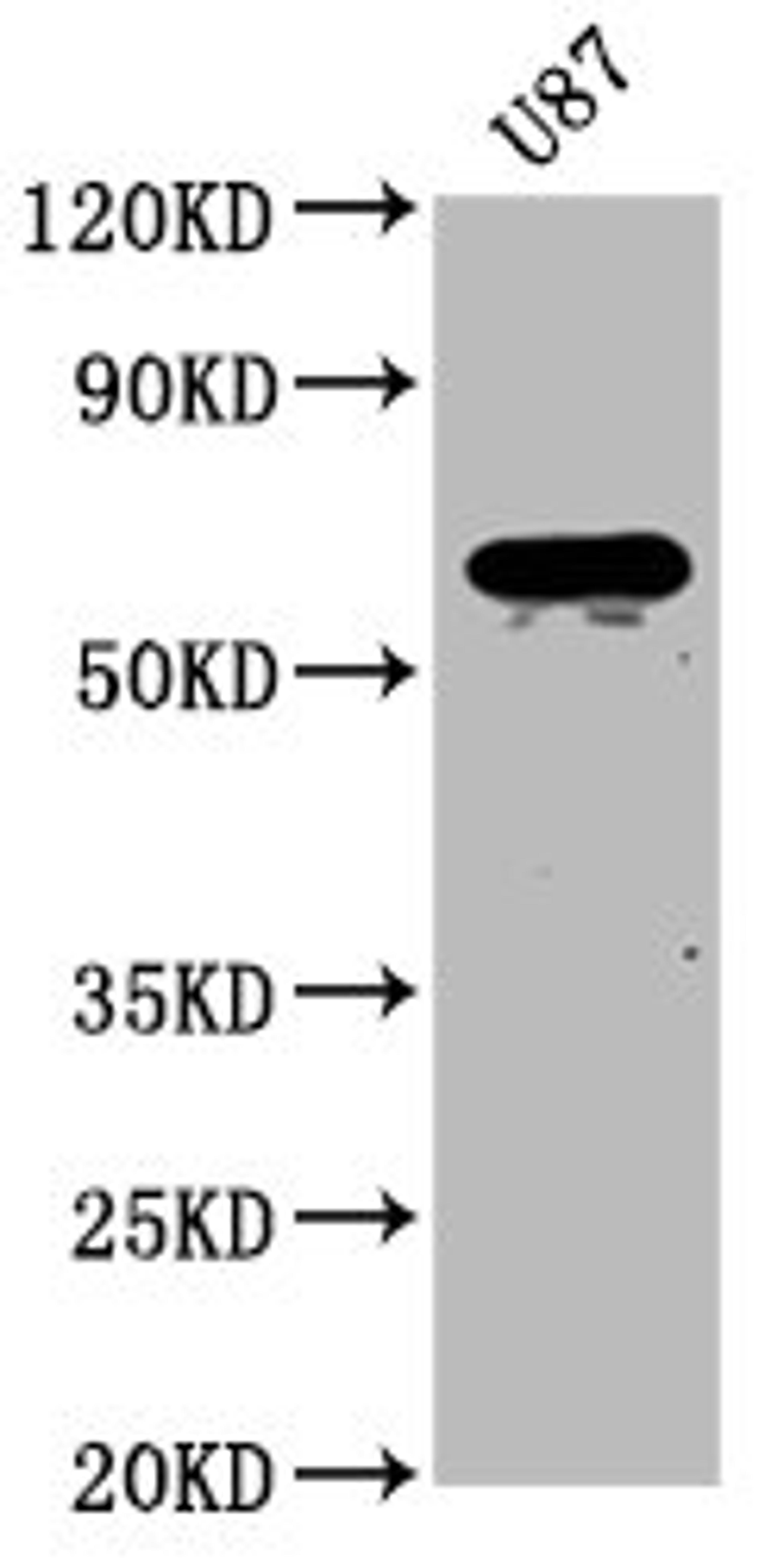 Western Blot. Positive WB detected in: U87 whole cell lysate. All lanes: NPRL3 antibody at 2.7µg/ml. Secondary. Goat polyclonal to rabbit IgG at 1/50000 dilution. Predicted band size: 64 kDa. Observed band size: 64 kDa