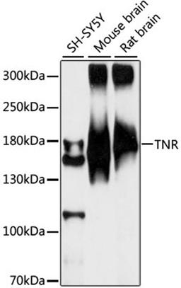 Western blot - TNR antibody (A15324)