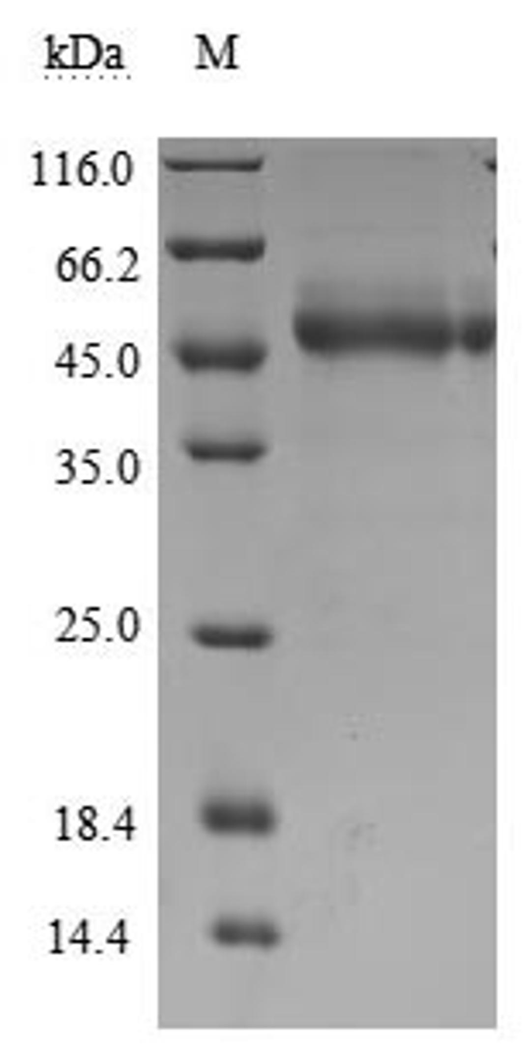 (Tris-Glycine gel) Discontinuous SDS-PAGE (reduced) with 5% enrichment gel and 15% separation gel.