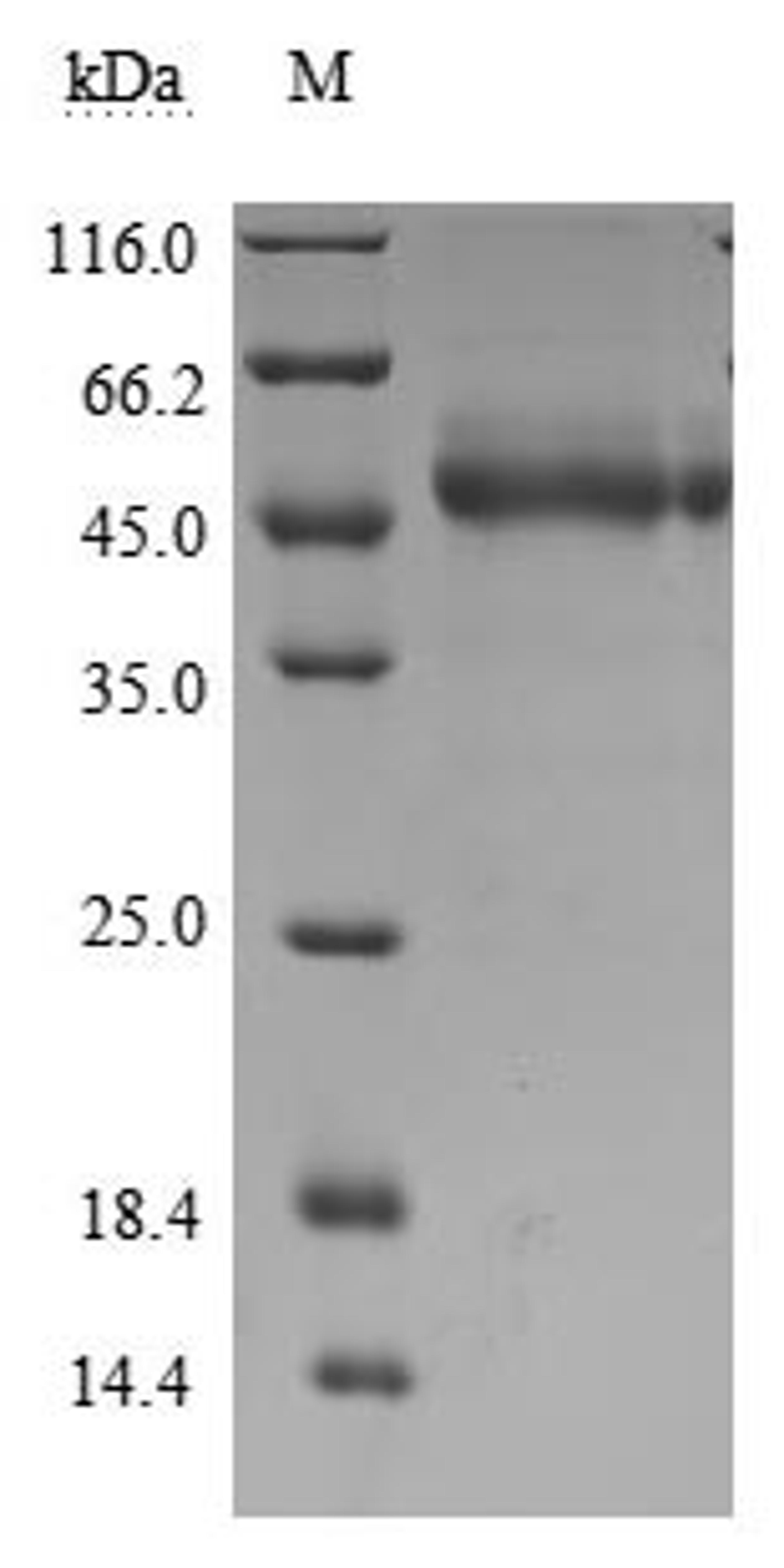 (Tris-Glycine gel) Discontinuous SDS-PAGE (reduced) with 5% enrichment gel and 15% separation gel.