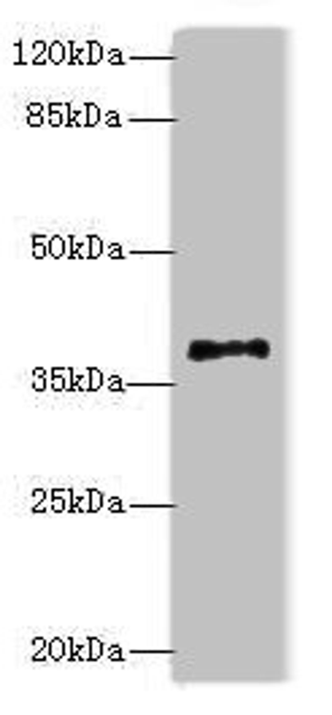 Western blot. All lanes: PLCXD1 antibody at 2ug/ml + Jurkat whole cell lysate. Secondary. Goat polyclonal to rabbit IgG at 1/10000 dilution. Predicted band size: 37 kDa. Observed band size: 37 kDa. 