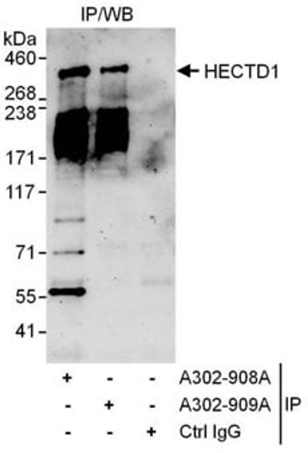 Detection of human HECTD1 by western blot of immunoprecipitates.