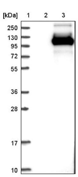 Western Blot: TCTN2 Antibody [NBP1-88392] - Lane 1: Marker [kDa] 250, 130, 95, 72, 55, 36, 28, 17, 10<br/>Lane 2: Negative control (vector only transfected HEK293T lysate)<br/>Lane 3: Over-expression lysate (Co-expressed with a C-terminal myc-DDK tag (~3.1 kDa) in mammalian HEK293T cells, LY411064)