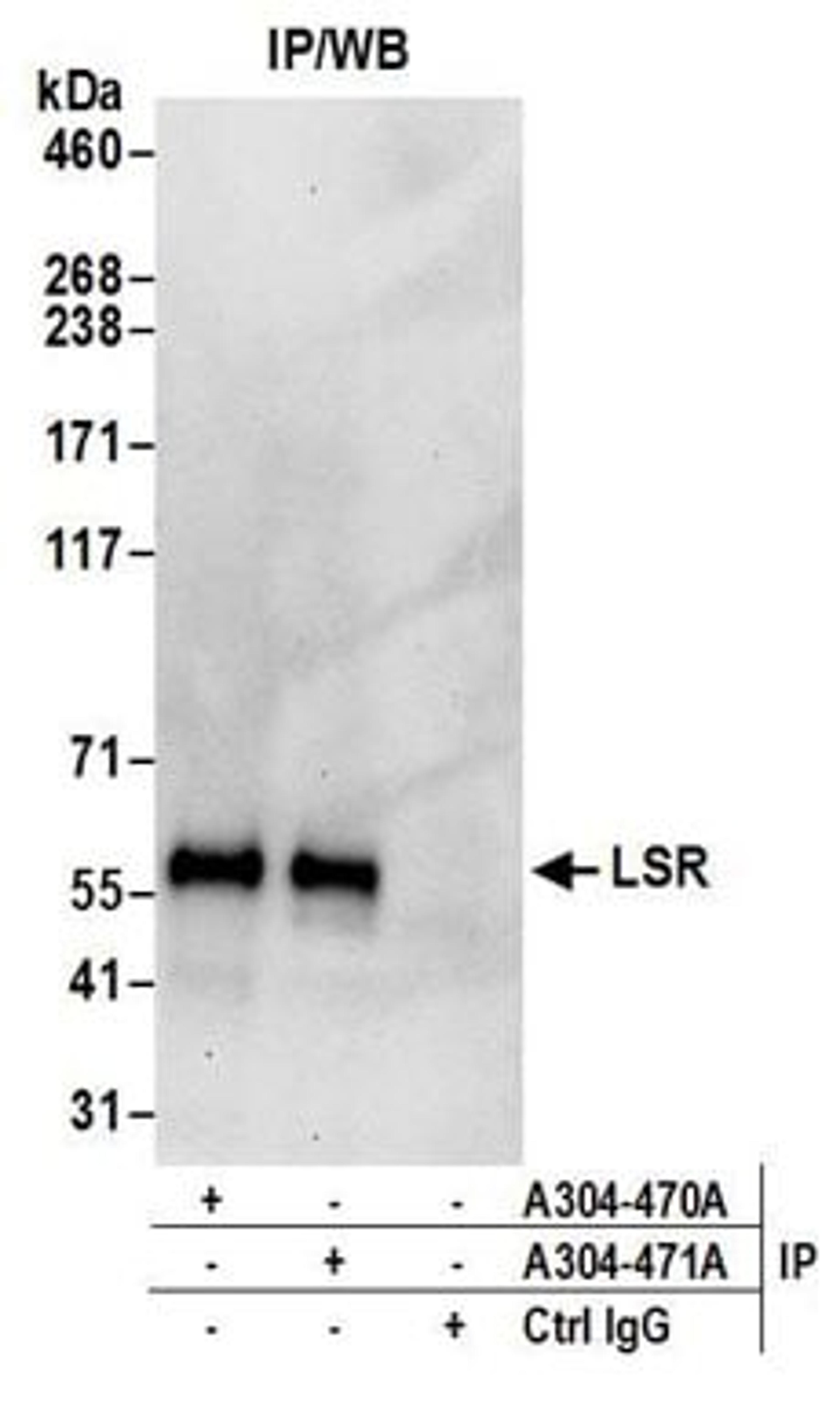 Detection of human LSR by western blot of immunoprecipitates.