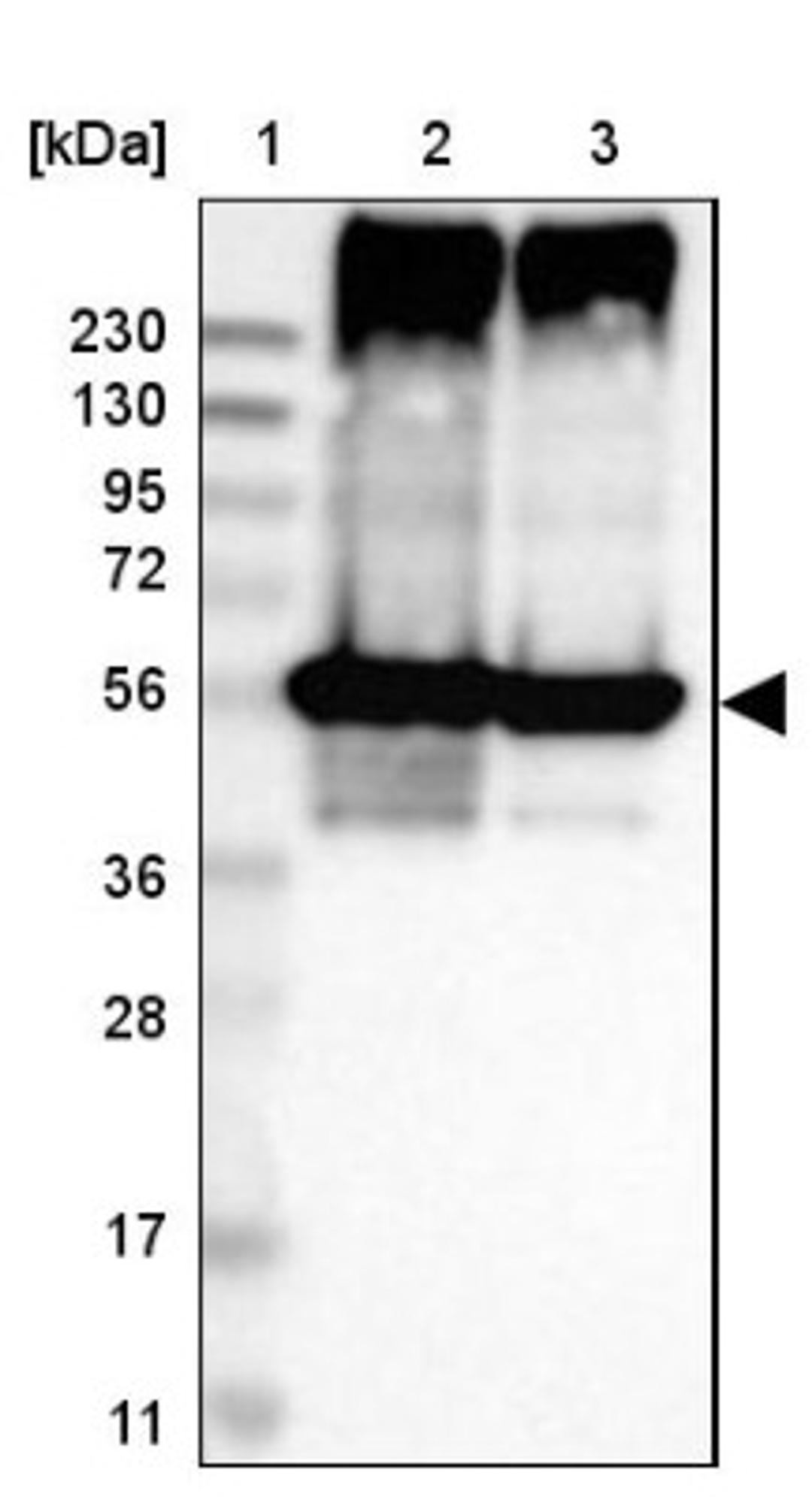 Western Blot: LPCAT2 Antibody [NBP1-88921] - Lane 1: Marker [kDa] 230, 130, 95, 72, 56, 36, 28, 17, 11<br/>Lane 2: Human cell line RT-4<br/>Lane 3: Human cell line U-251MG sp