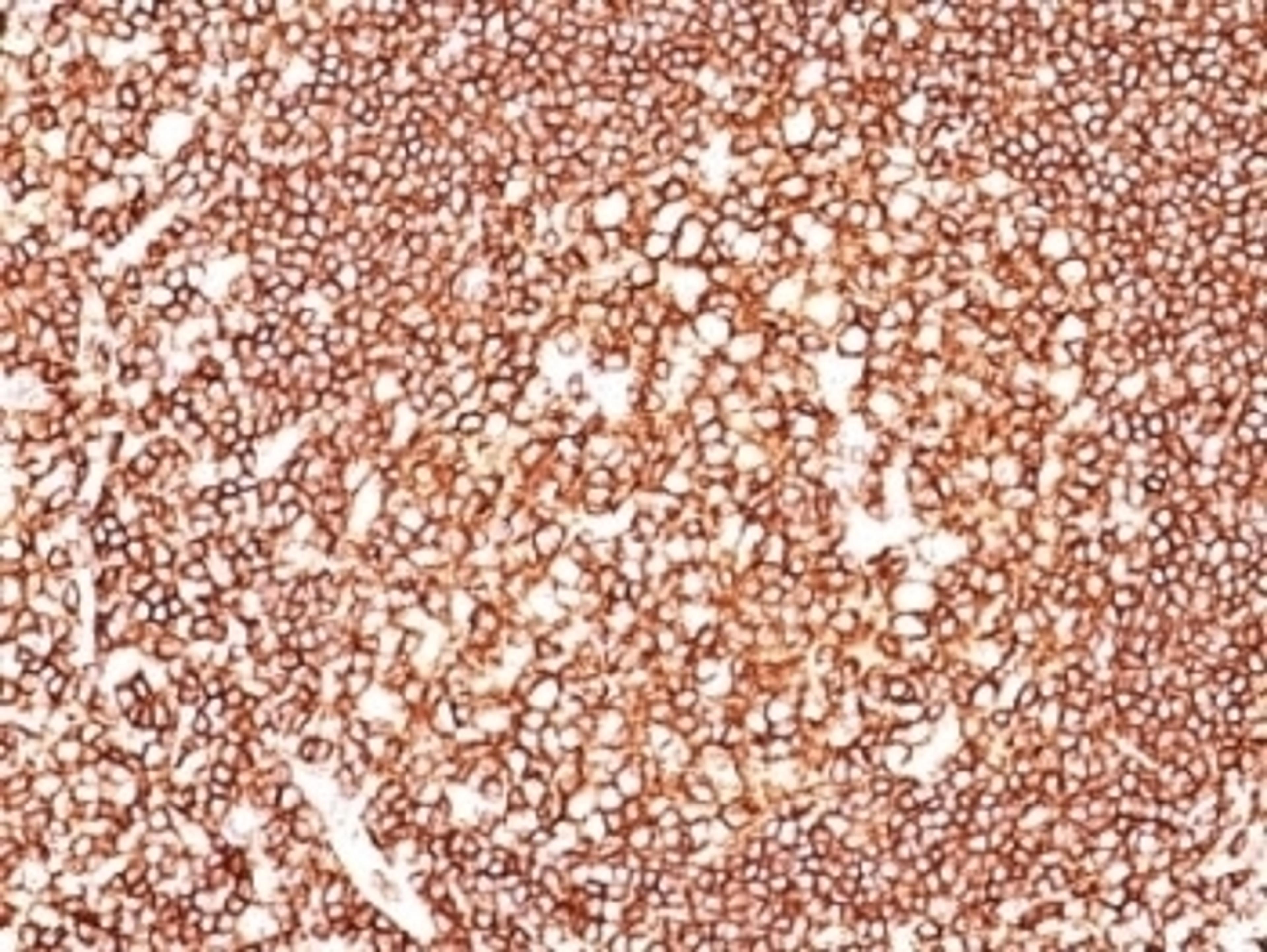 IHC testing of human tonsil with CD45 antibody