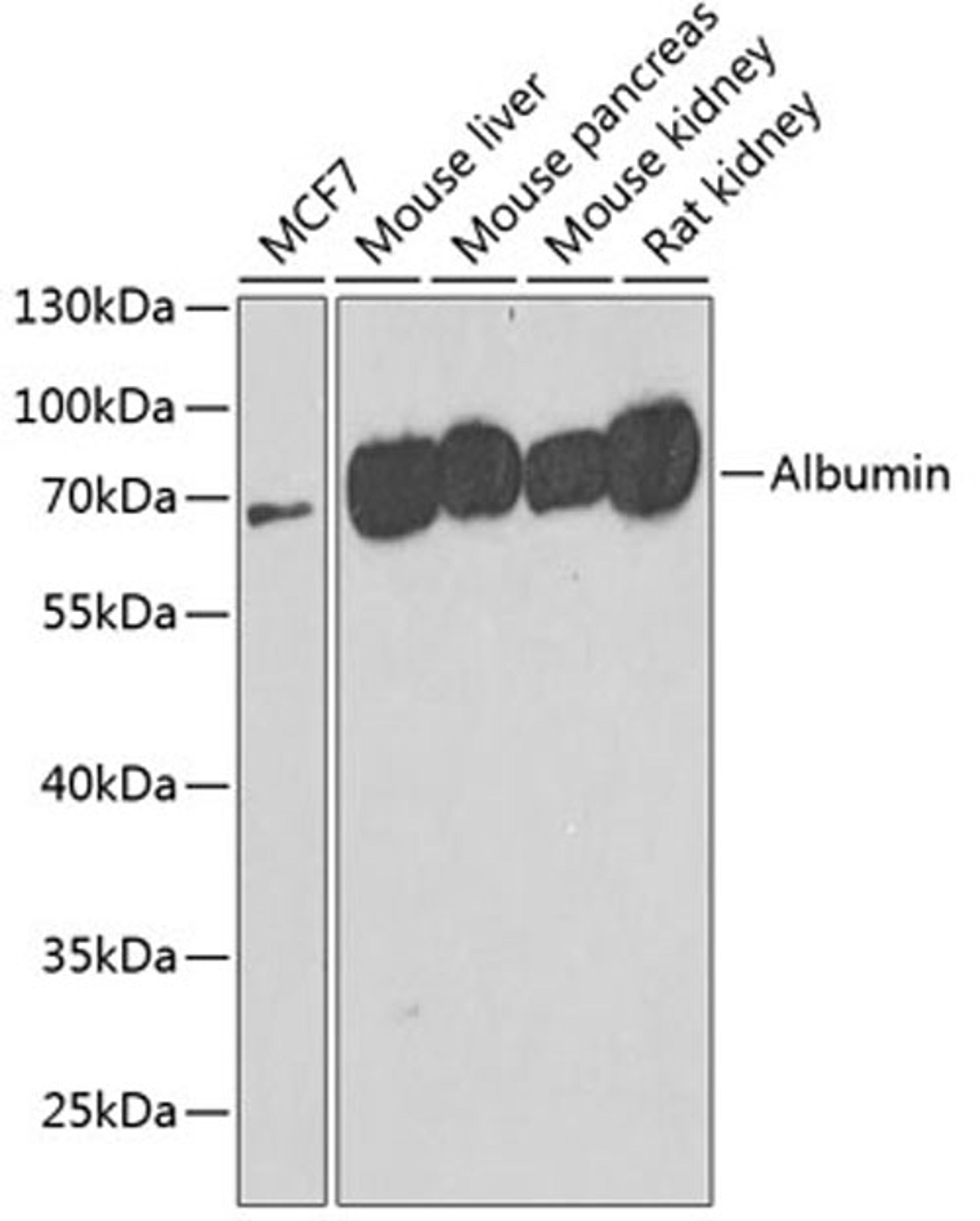 Western blot - Albumin antibody (A1363)