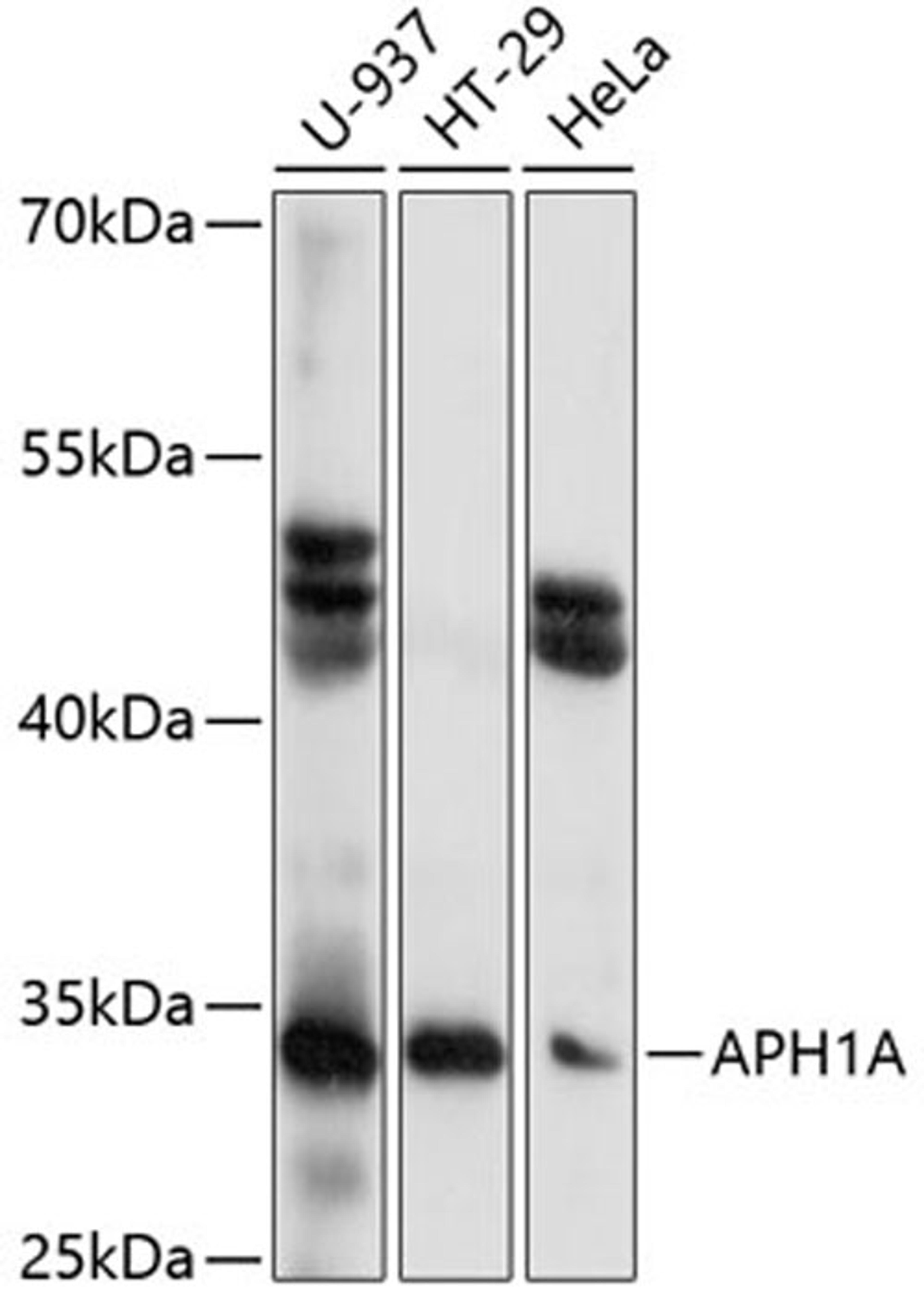 Western blot - APH1A antibody (A14666)