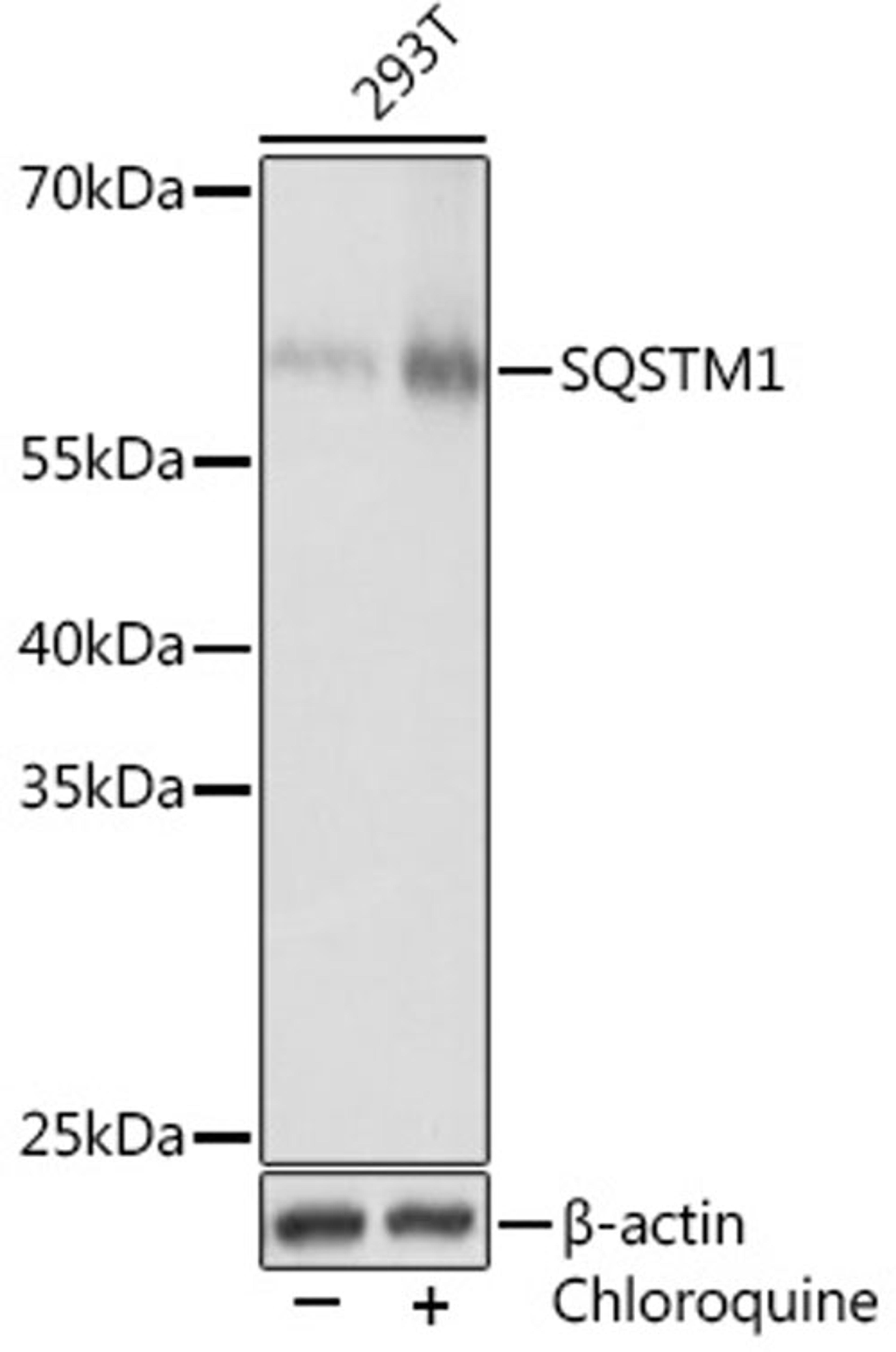 Western blot - SQSTM1 Rabbit pAb (A11246)