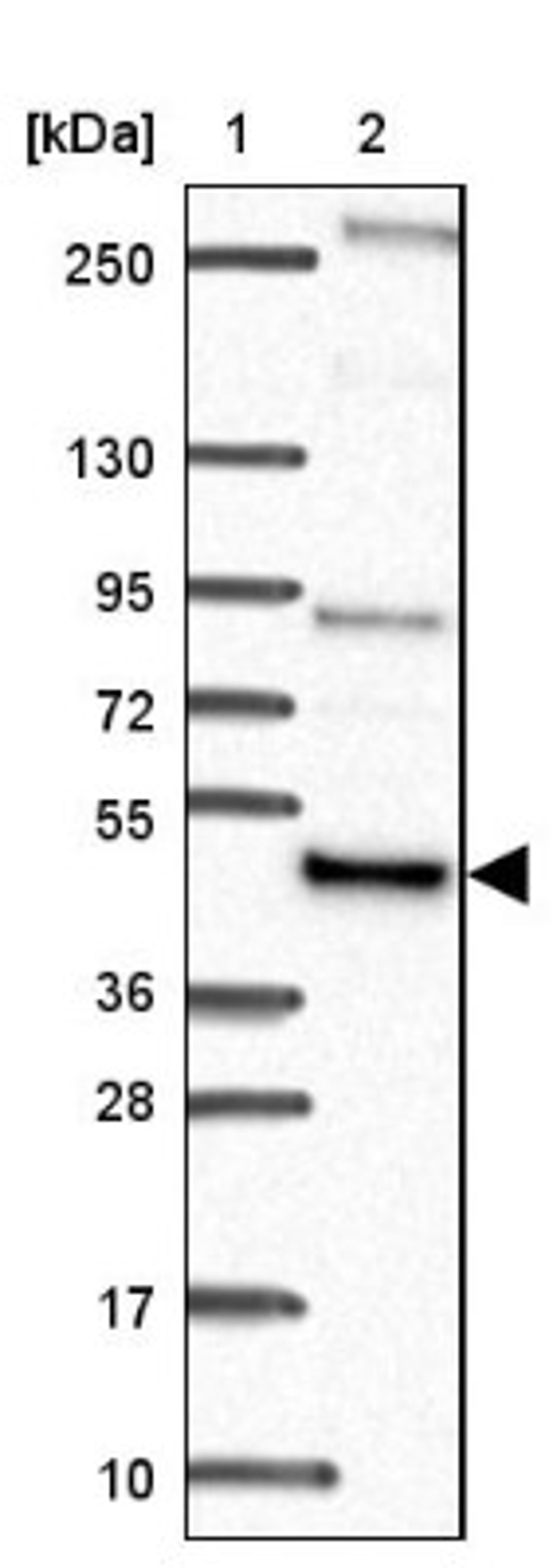 Western Blot: NFS1 Antibody [NBP2-38737] - Lane 1: Marker [kDa] 250, 130, 95, 72, 55, 36, 28, 17, 10<br/>Lane 2: RT-4