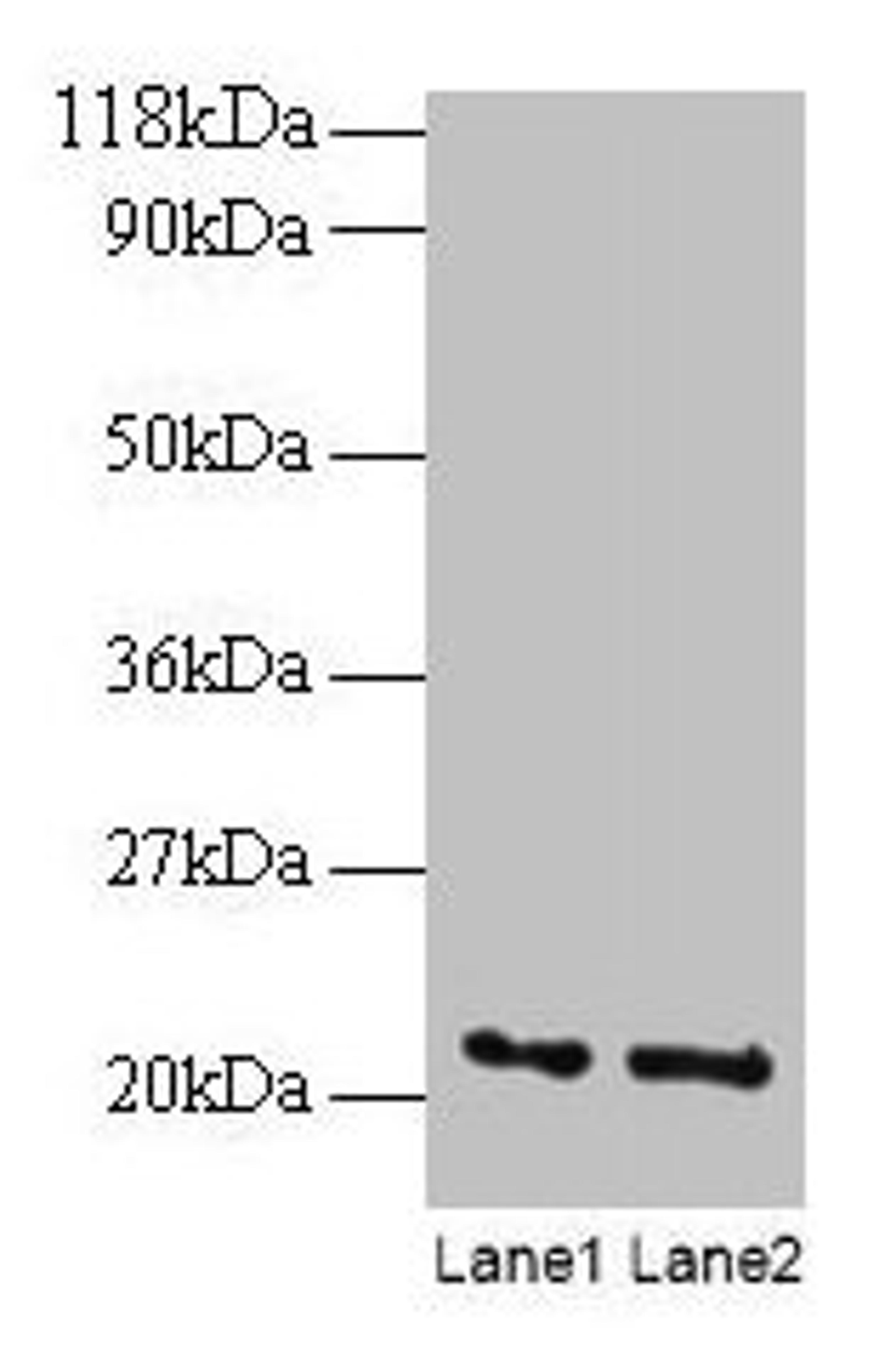 Western blot. All lanes: ARF4 antibody at 2µg/ml. Lane 1: EC109 whole cell lysate. Lane 2: 293T whole cell lysate. Secondary. Goat polyclonal to rabbit IgG at 1/15000 dilution. Predicted band size: 21 kDa. Observed band size: 21 kDa