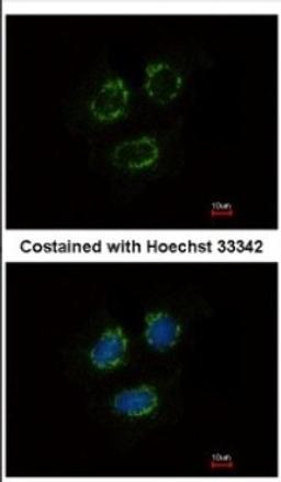 Immunocytochemistry/Immunofluorescence: TTLL10 Antibody [NBP2-20755] - Immunofluorescence analysis of methanol-fixed MCF-7, using antibody at 1:500 dilution.