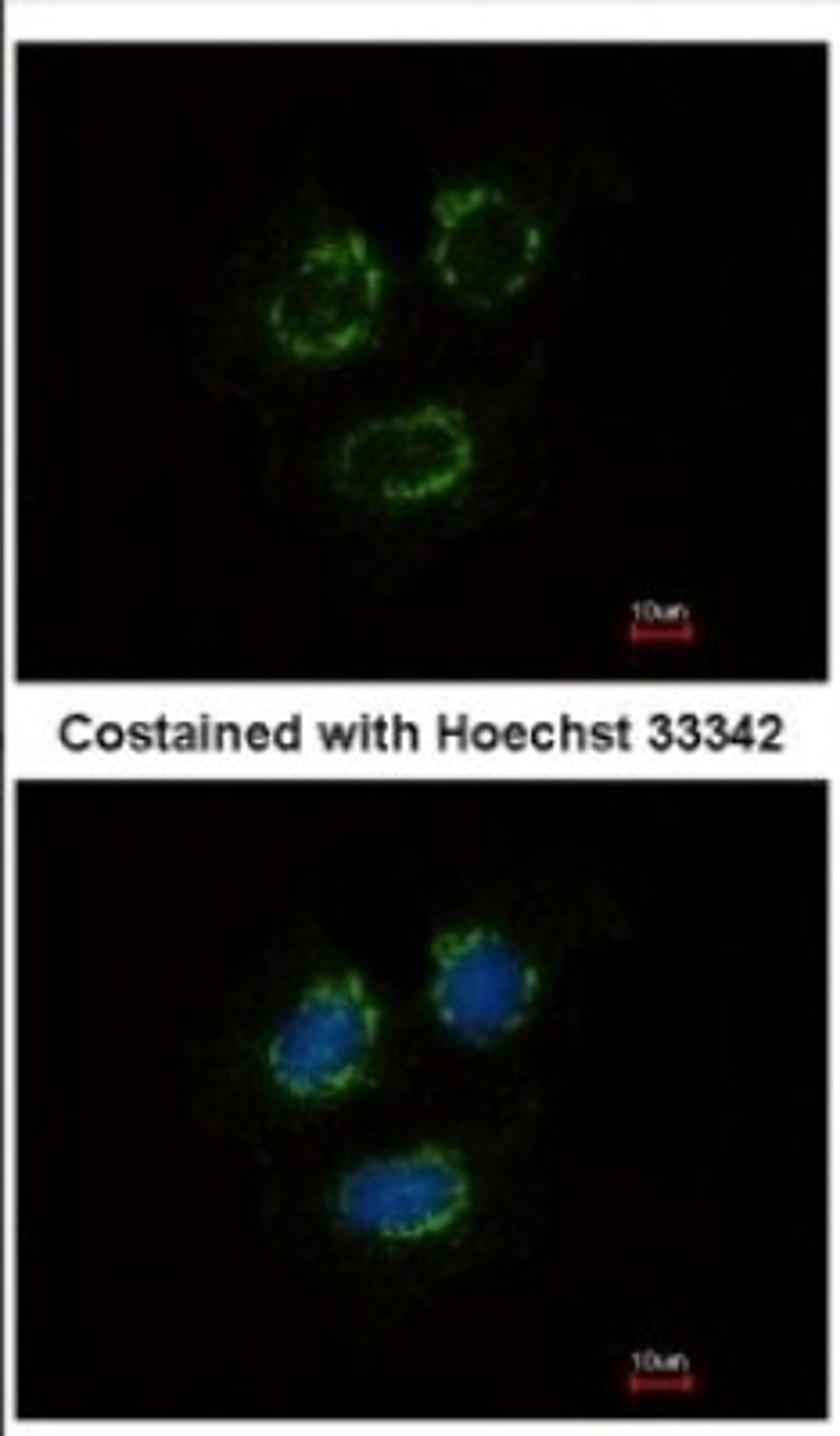 Immunocytochemistry/Immunofluorescence: TTLL10 Antibody [NBP2-20755] - Immunofluorescence analysis of methanol-fixed MCF-7, using antibody at 1:500 dilution.