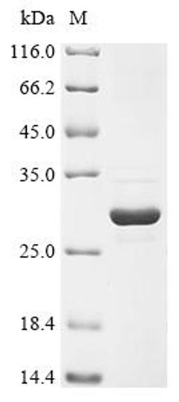 (Tris-Glycine gel) Discontinuous SDS-PAGE (reduced) with 5% enrichment gel and 15% separation gel.