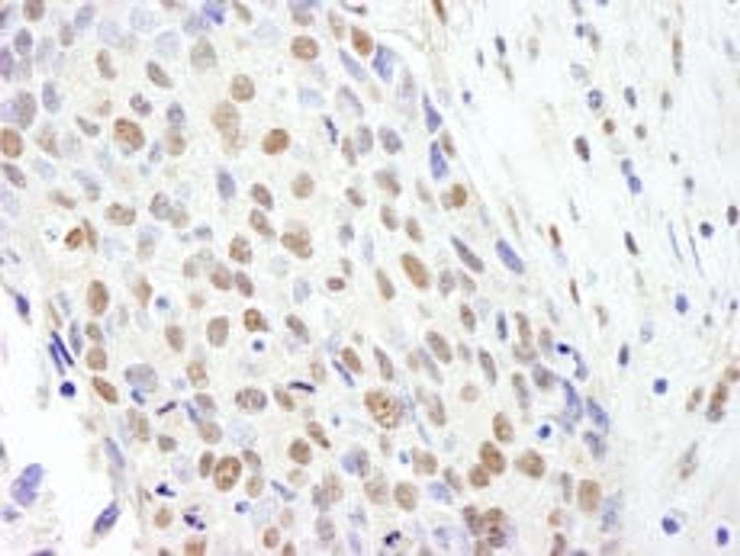 Detection of human SF3b145/SAP145 by immunohistochemistry.