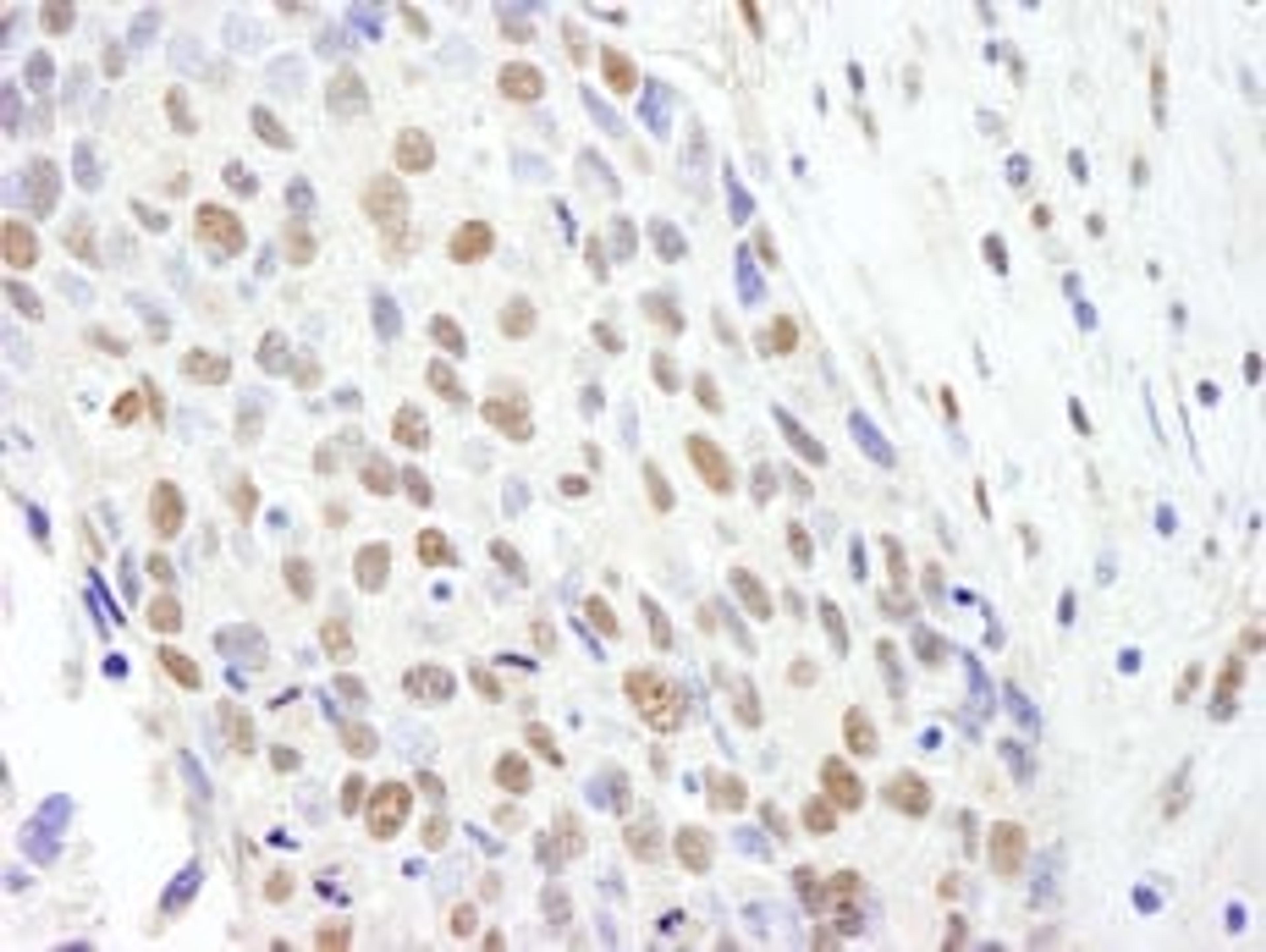 Detection of human SF3b145/SAP145 by immunohistochemistry.