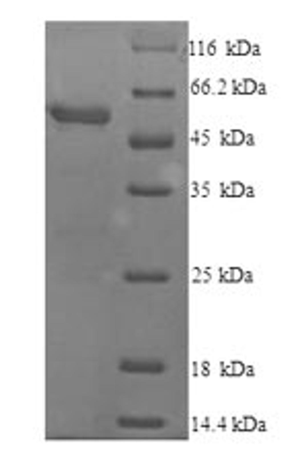 (Tris-Glycine gel) Discontinuous SDS-PAGE (reduced) with 5% enrichment gel and 15% separation gel.