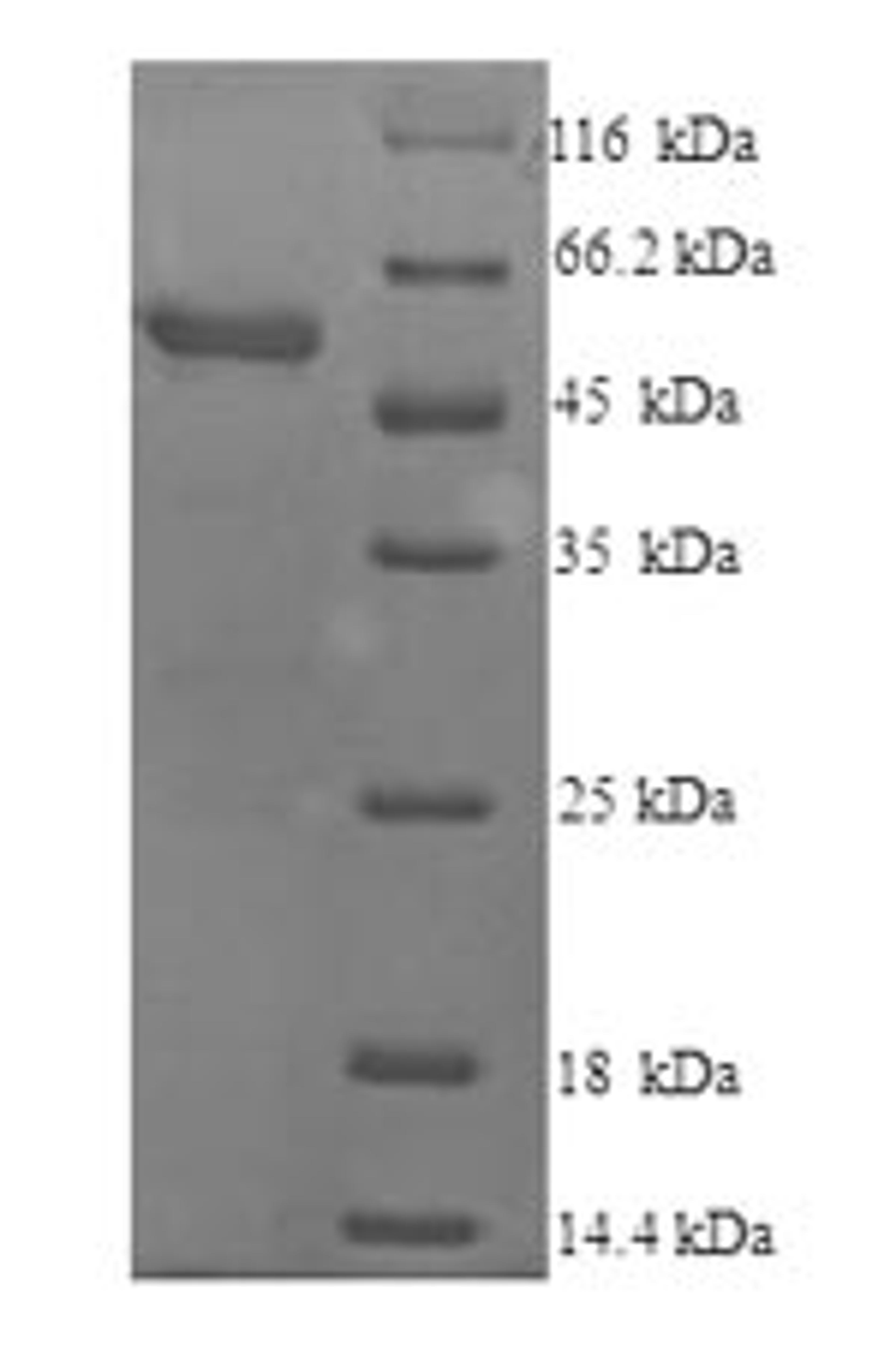 (Tris-Glycine gel) Discontinuous SDS-PAGE (reduced) with 5% enrichment gel and 15% separation gel.
