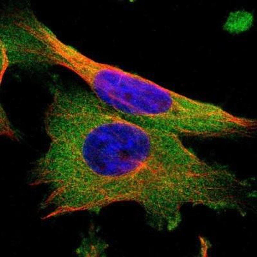 Immunocytochemistry/Immunofluorescence: Seryl tRNA synthetase Antibody [NBP1-80765] - Staining of human cell line U-251MG shows positivity in cytoplasm.