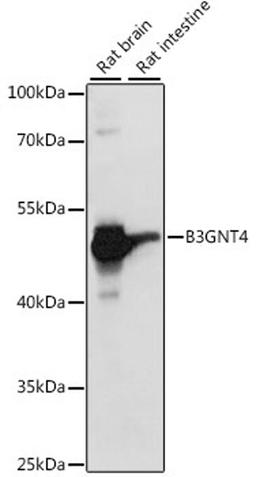 Western blot - B3GNT4 antibody (A15896)