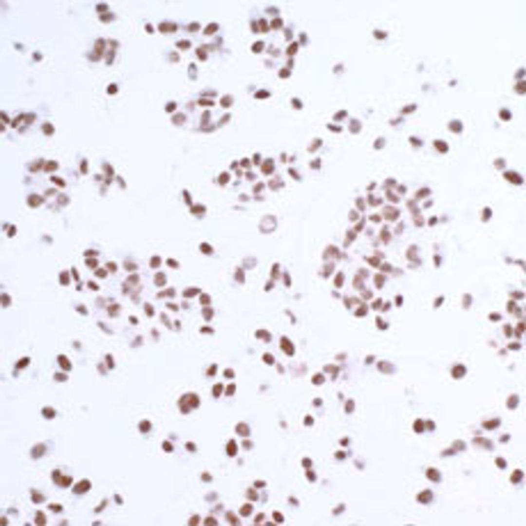 Detection of human USP7/HAUSP by immunocytochemistry.