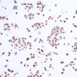 Detection of human USP7/HAUSP by immunocytochemistry.