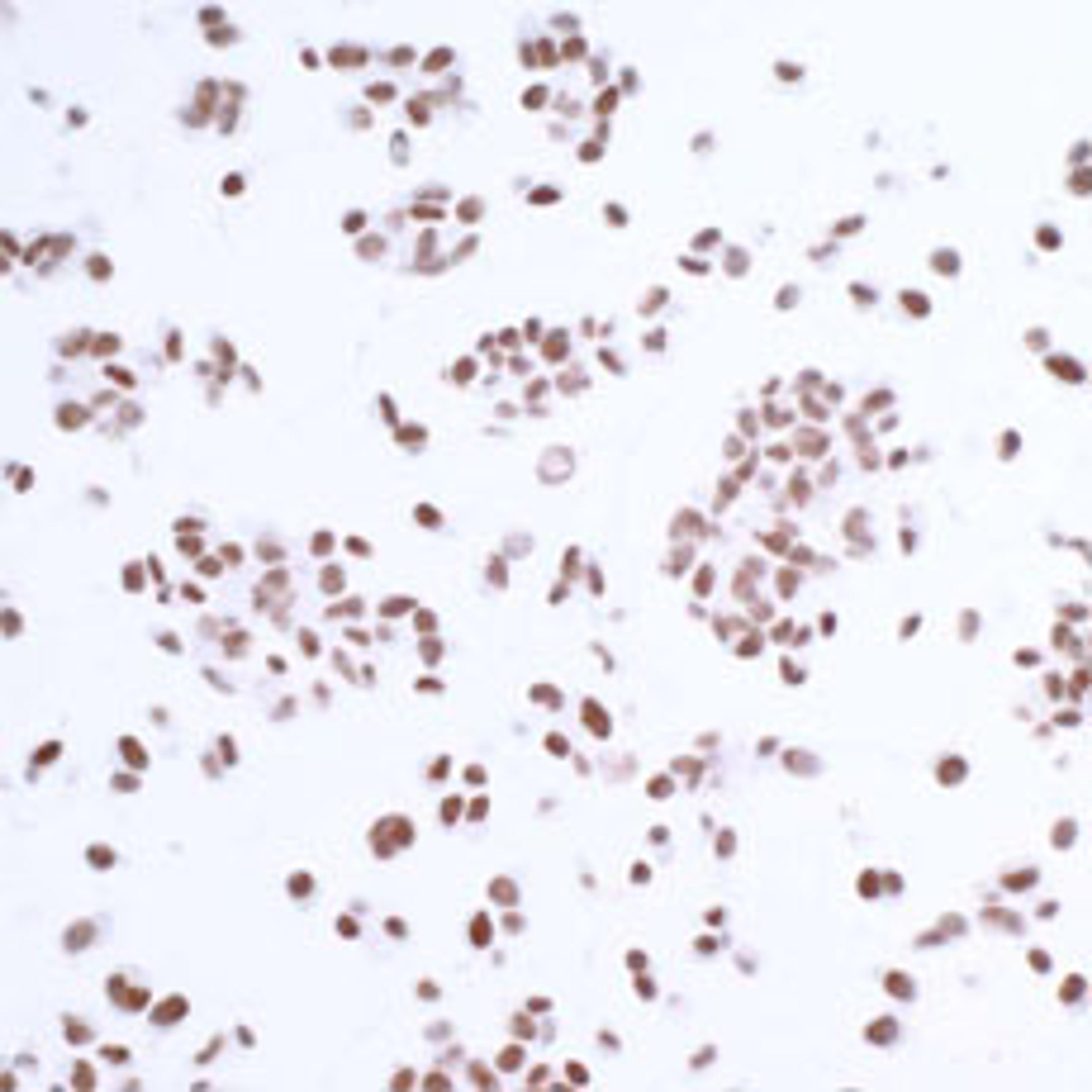 Detection of human USP7/HAUSP by immunocytochemistry.