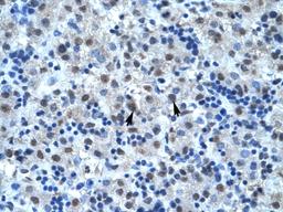 Antibody used in IHC on Human Liver.