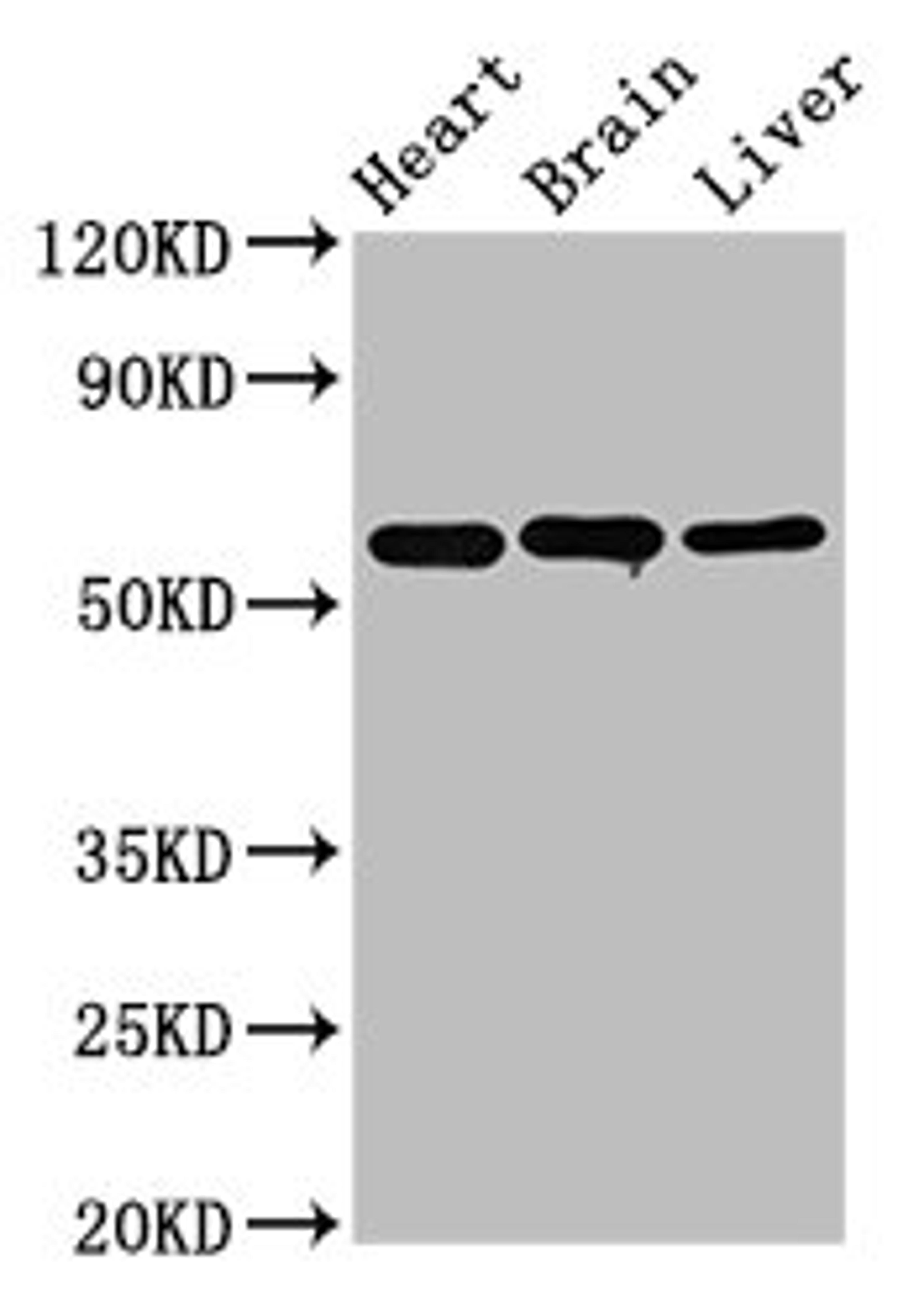 Western Blot. Positive WB detected in: Rat heart tissue, Rat brain tissue, Mouse liver tissue. All lanes: ALDH5A1 antibody at 3.2µg/ml. Secondary. Goat polyclonal to rabbit IgG at 1/50000 dilution. Predicted band size: 58, 59 kDa. Observed band size: 58 kDa