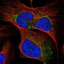 Immunocytochemistry/Immunofluorescence: SLC25A36 Antibody [NBP1-84617] - Staining of human cell line U-2 OS shows positivity in nucleus but not nucleoli, cytoplasm & mitochondria.