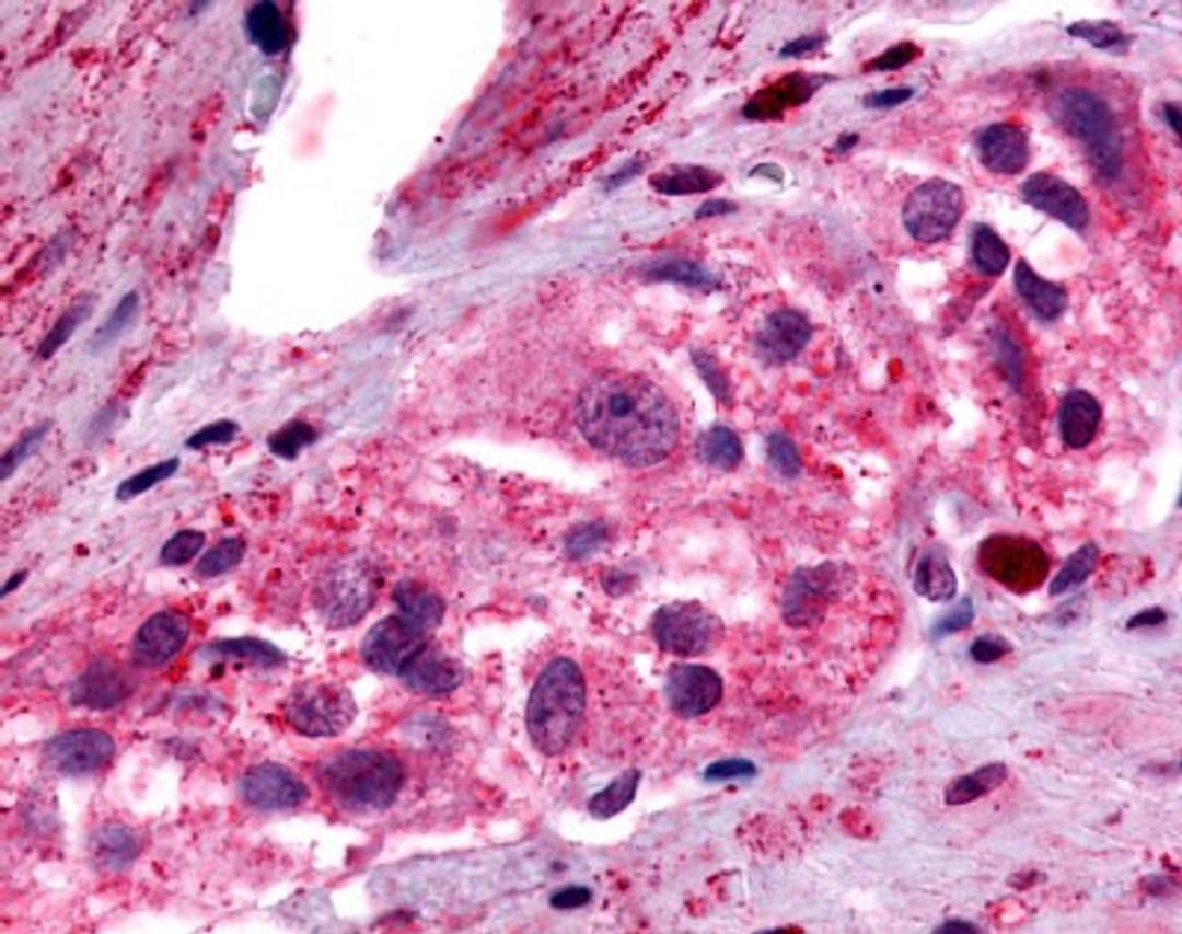 Immunohistochemistry-Paraffin: PTGER4/EP4 Antibody [NLS3898] - Analysis of anti-PTGER4 / EP4 antibody with human colon, ganglion 8 ug/ml.