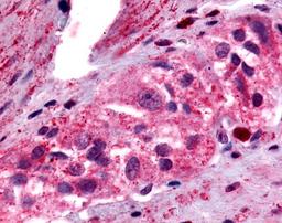 Immunohistochemistry-Paraffin: PTGER4/EP4 Antibody [NLS3898] - Analysis of anti-PTGER4 / EP4 antibody with human colon, ganglion 8 ug/ml.