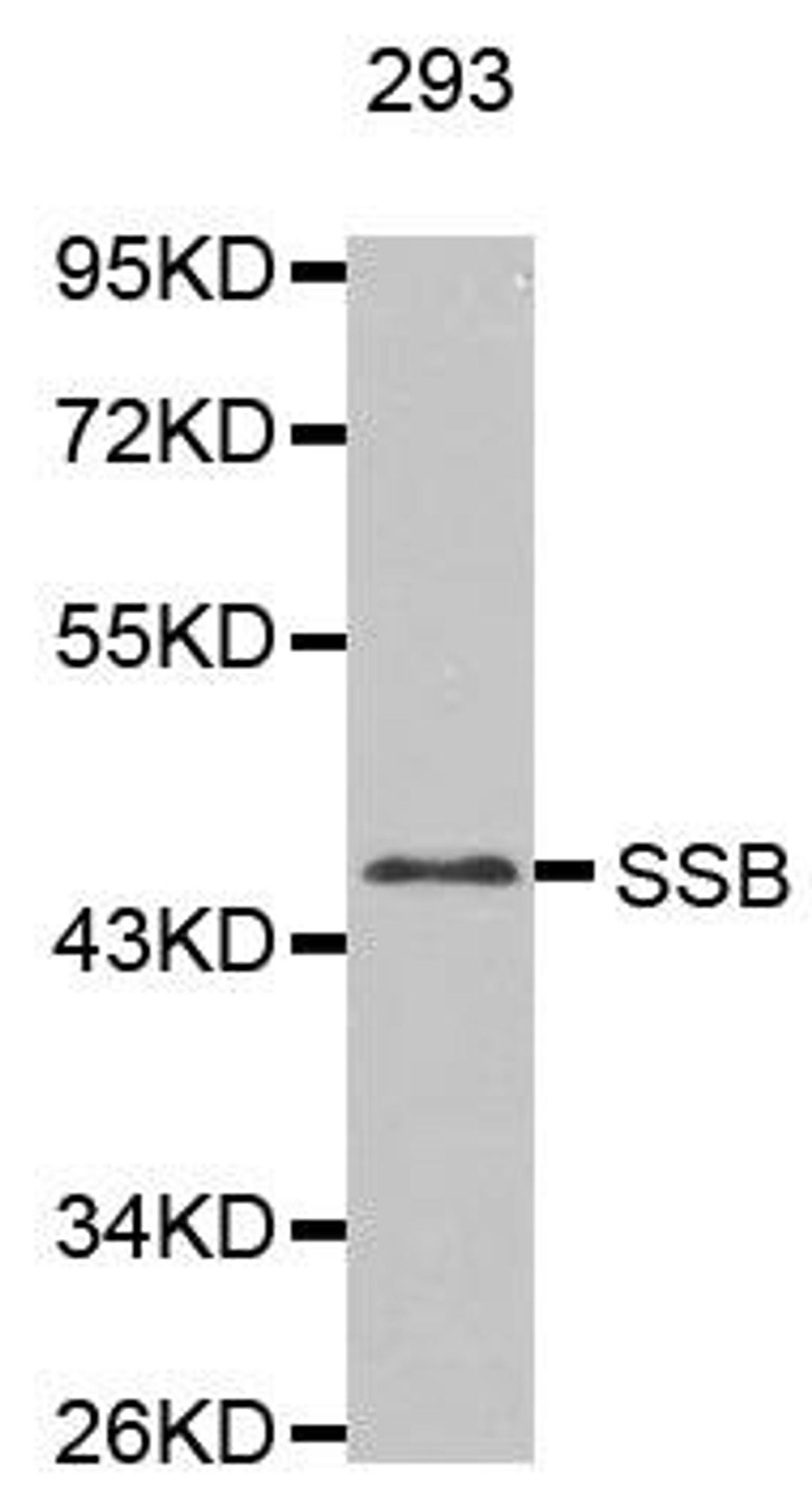 Western blot analysis of extracts of 293 cell line using La Antigen antibody